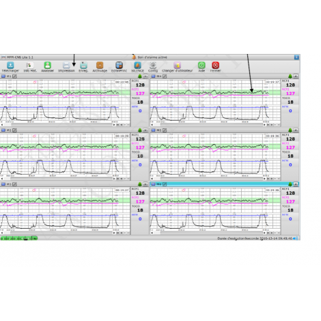 LOGICIEL POUR EDAN F3